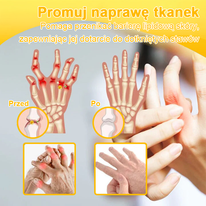 TLOPA® Toksyna botulinowa i jad pszczeli Balsam Łagodzący Ból i Leczenie Kości🐝🌿 (Polecane dla seniorów przez ortopedów)🔥🔥