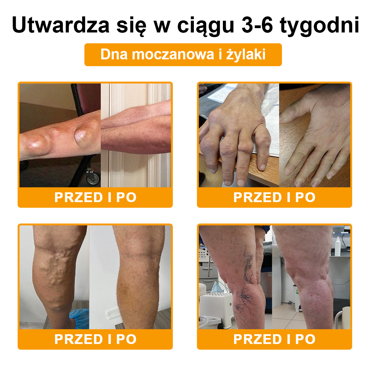 TLOPA® Toksyna botulinowa i jad pszczeli Balsam Łagodzący Ból i Leczenie Kości🐝🌿 (Polecane dla seniorów przez ortopedów)🔥🔥