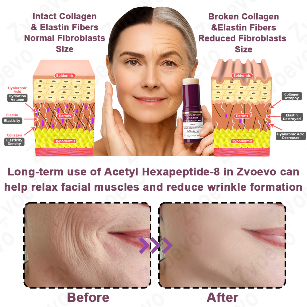 ✅ Oficjalny Sklep Flagowy: Zvoevo® Calcium Collagen Repair Lip Balm 👨⚕️ Certyfikat TGA (Celuje w zmarszczki i drobne linie, wygładza bruzdy nosowo-wargowe i zmarszczki na szyi, redukuje zmarszczki na czole)