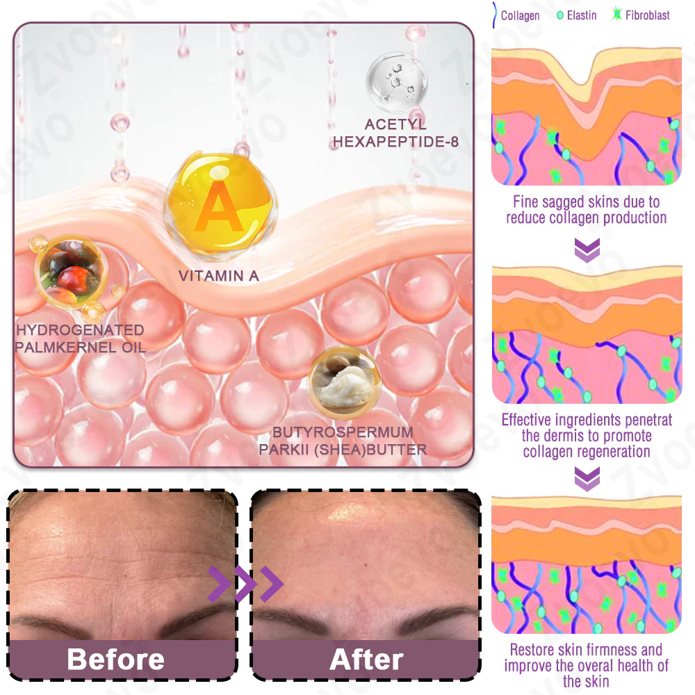 ✅ Oficjalny Sklep Flagowy: Zvoevo® Calcium Collagen Repair Lip Balm 👨⚕️ Certyfikat TGA (Celuje w zmarszczki i drobne linie, wygładza bruzdy nosowo-wargowe i zmarszczki na szyi, redukuje zmarszczki na czole)
