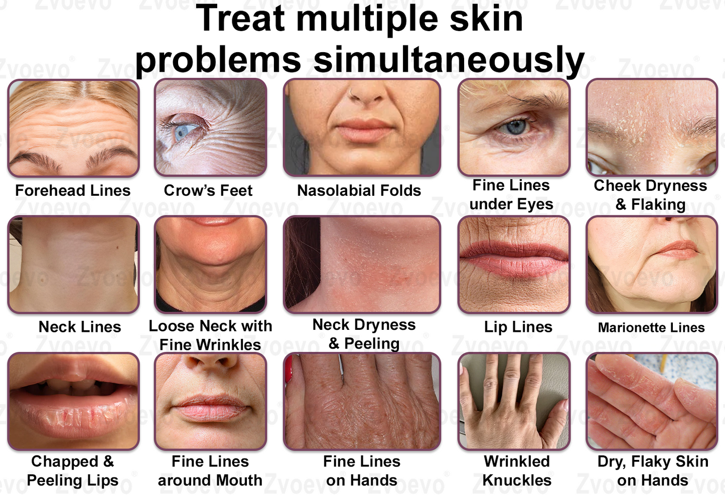 ✅ Oficjalny Sklep Flagowy: Zvoevo® Calcium Collagen Repair Lip Balm 👨⚕️ Certyfikat TGA (Celuje w zmarszczki i drobne linie, wygładza bruzdy nosowo-wargowe i zmarszczki na szyi, redukuje zmarszczki na czole)