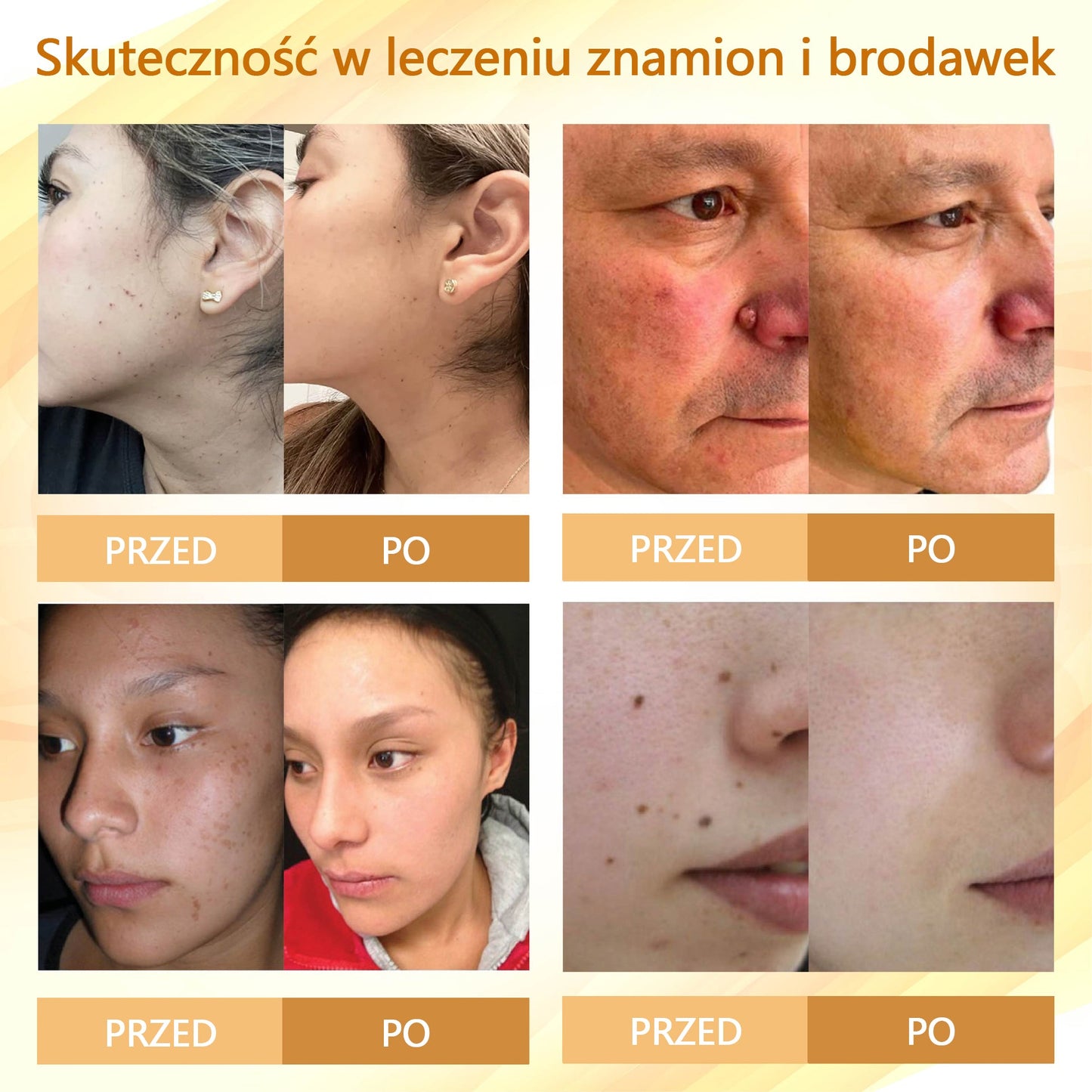 Krem regenerujący skórę Croaie® condense mellifera 🌻