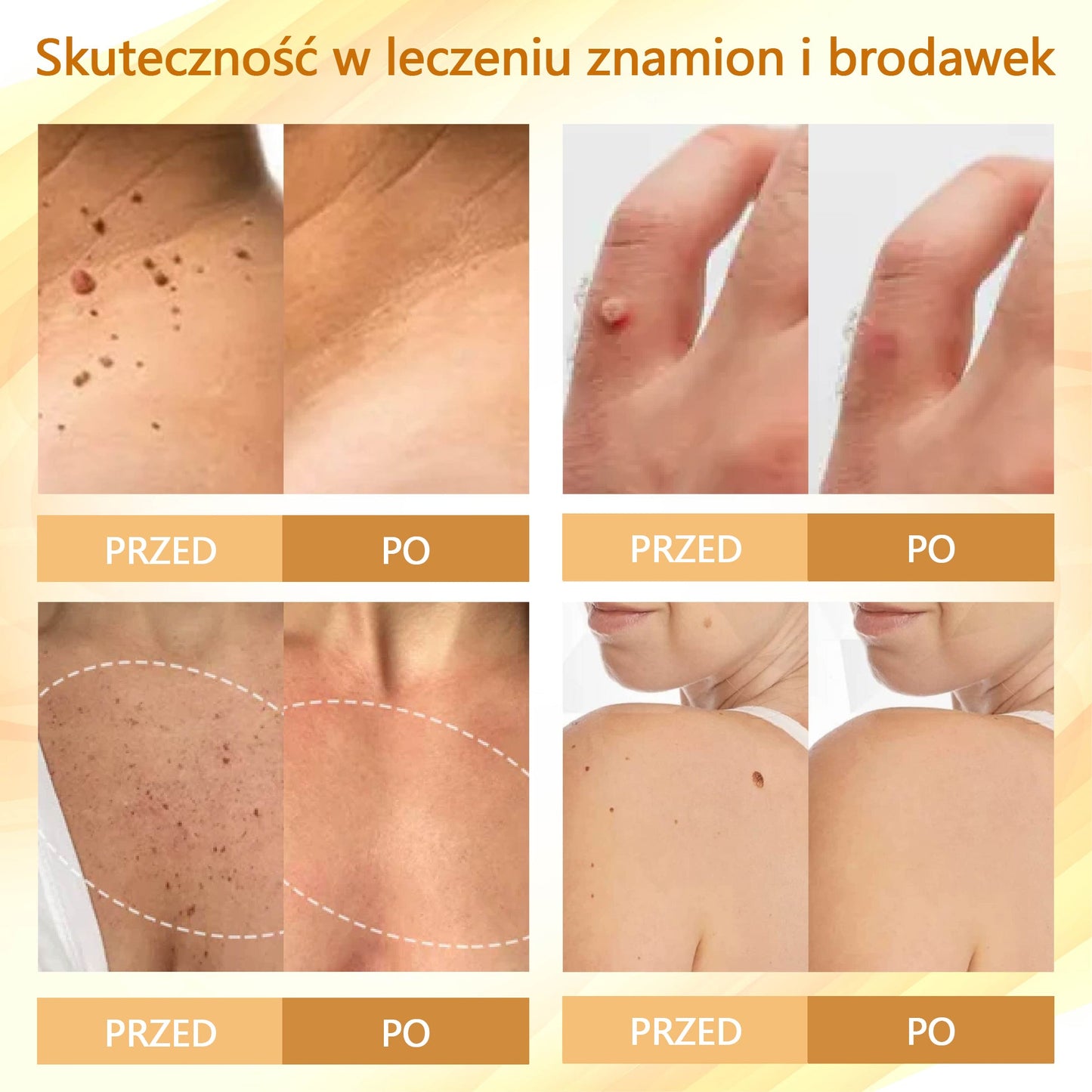 Krem regenerujący skórę Croaie® condense mellifera 🌻