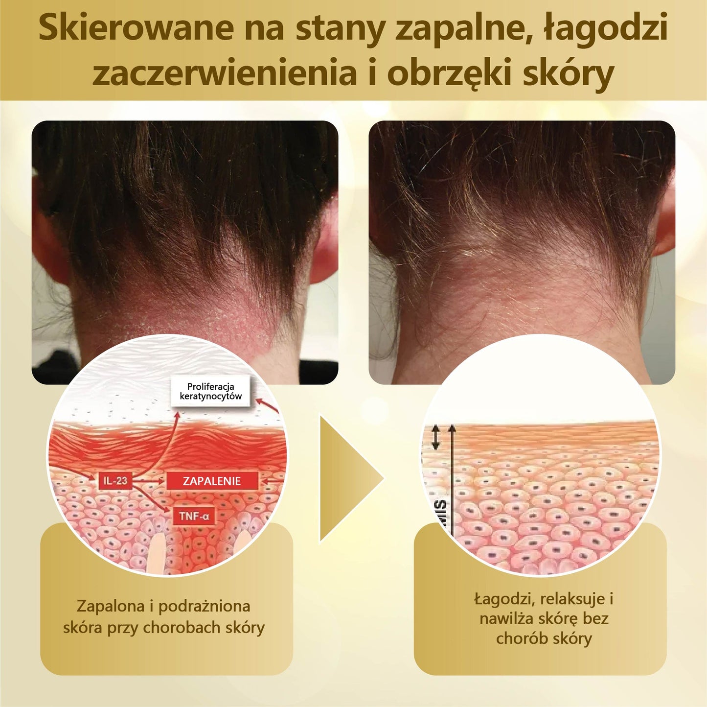 Krem regenerujący skórę Croaie® condense mellifera 🌻