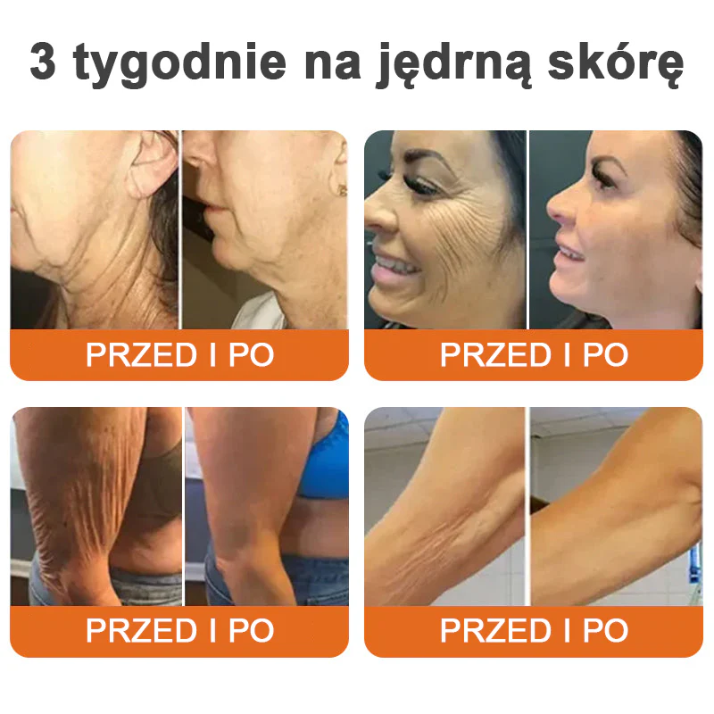 🌴🎁Wyprodukowane i wysłane z Australii - Flysmus® AH-8 Krem do napięcia i liftingu szyi