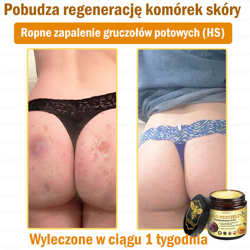 VLSVLS™ Krem Komprehensywny z Jadami Pszczół 👩‍⚕️ Rekomendowany przez Dermatologów