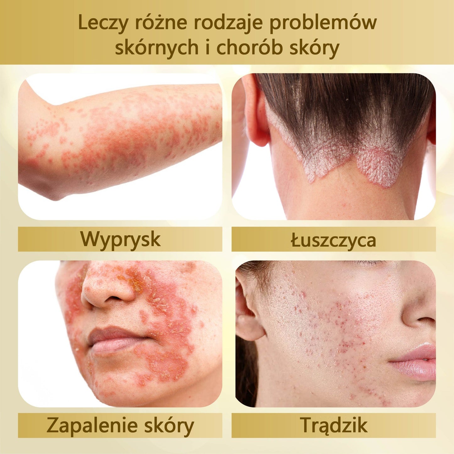 Krem regenerujący skórę Croaie® condense mellifera  🌻