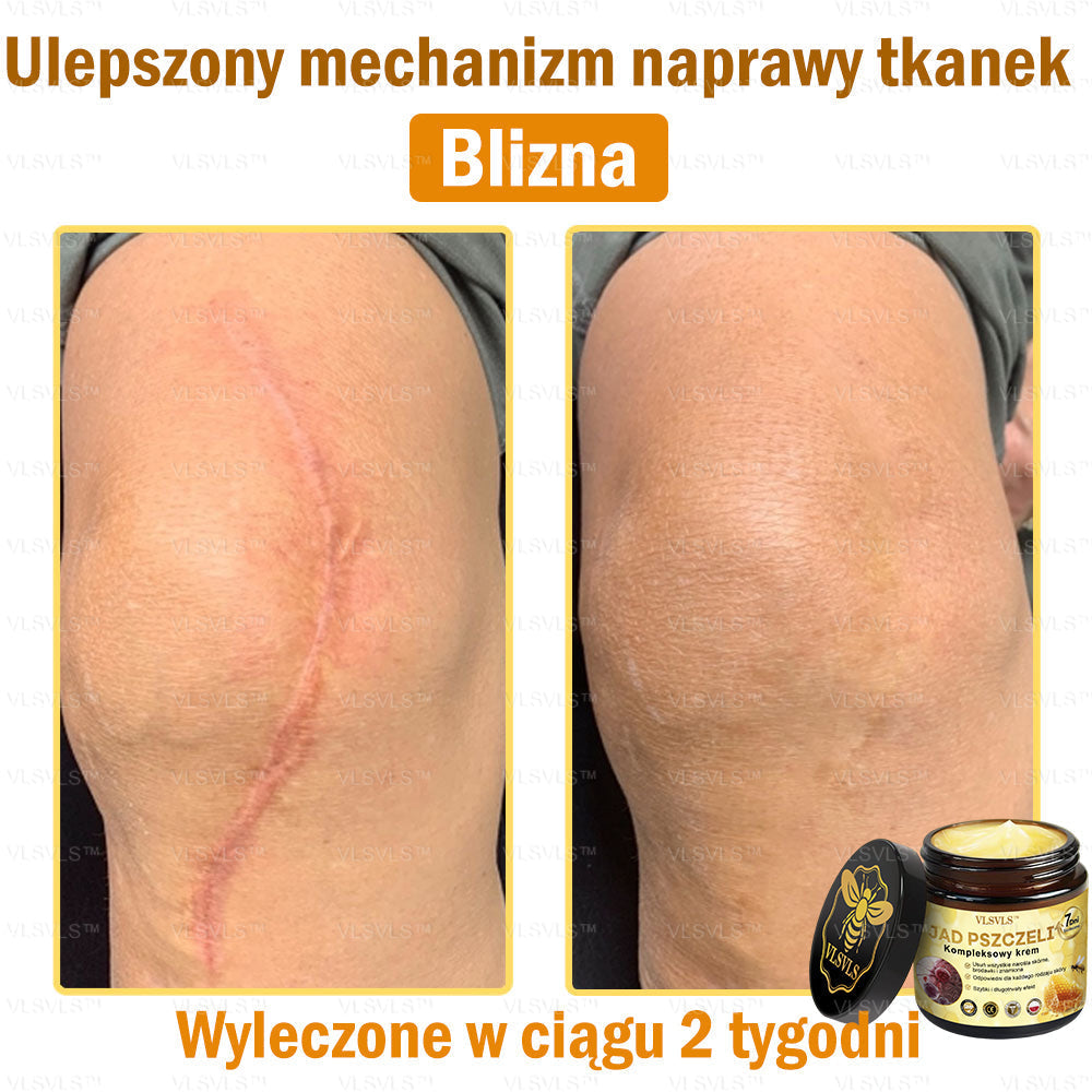 VLSVLS™ Krem Komprehensywny z Jadami Pszczół 👩‍⚕️ Rekomendowany przez Dermatologów