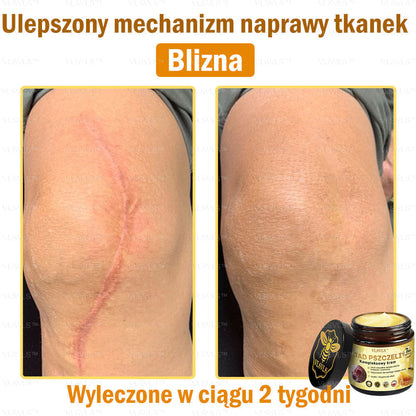VLSVLS™ Krem Komprehensywny z Jadami Pszczół 👩‍⚕️ Rekomendowany przez Dermatologów