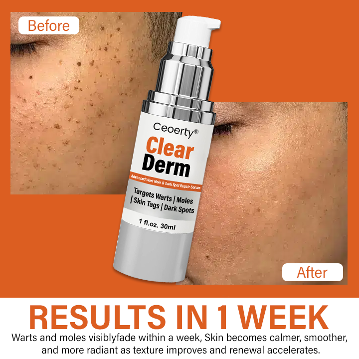 Ceoerty® ClearDerm Zaawansowane serum do usuwania brodawek, znamion i ciemnych plam