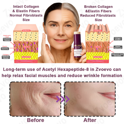 ✅ Oficjalny Sklep Flagowy: Zvoevo® Calcium Collagen Repair Lip Balm 👨‍⚕️ Certyfikat TGA (Celuje w zmarszczki i drobne linie, wygładza bruzdy nosowo-wargowe i zmarszczki na szyi, redukuje zmarszczki na czole)