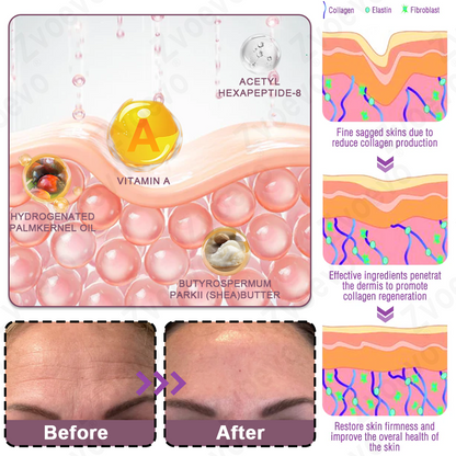 ✅ Oficjalny Sklep Flagowy: Zvoevo® Calcium Collagen Repair Lip Balm 👨‍⚕️ Certyfikat TGA (Celuje w zmarszczki i drobne linie, wygładza bruzdy nosowo-wargowe i zmarszczki na szyi, redukuje zmarszczki na czole)