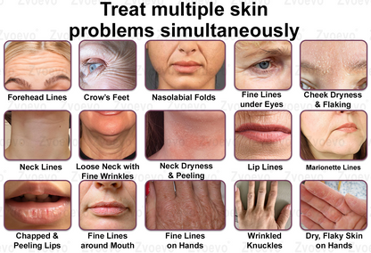 ✅ Oficjalny Sklep Flagowy: Zvoevo® Calcium Collagen Repair Lip Balm 👨‍⚕️ Certyfikat TGA (Celuje w zmarszczki i drobne linie, wygładza bruzdy nosowo-wargowe i zmarszczki na szyi, redukuje zmarszczki na czole)