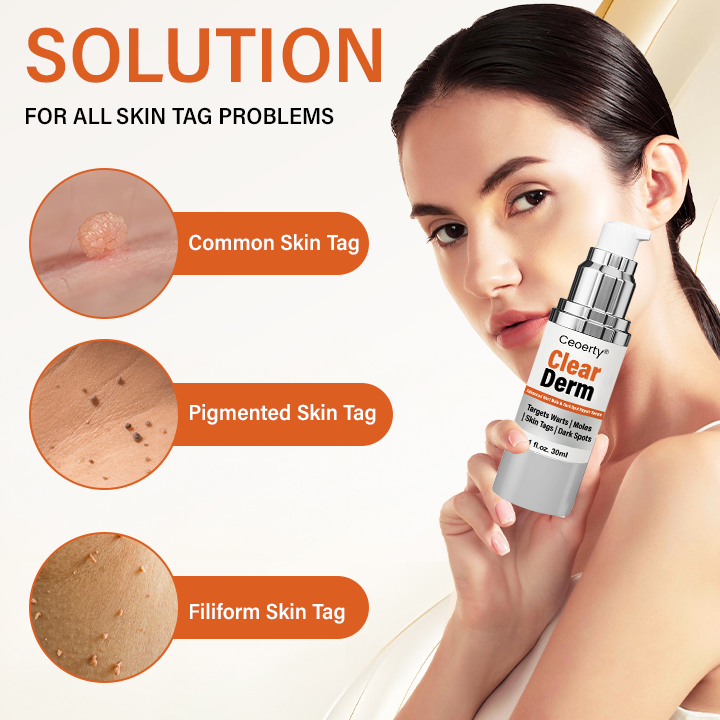Ceoerty® ClearDerm Zaawansowane serum do usuwania brodawek, znamion i ciemnych plam