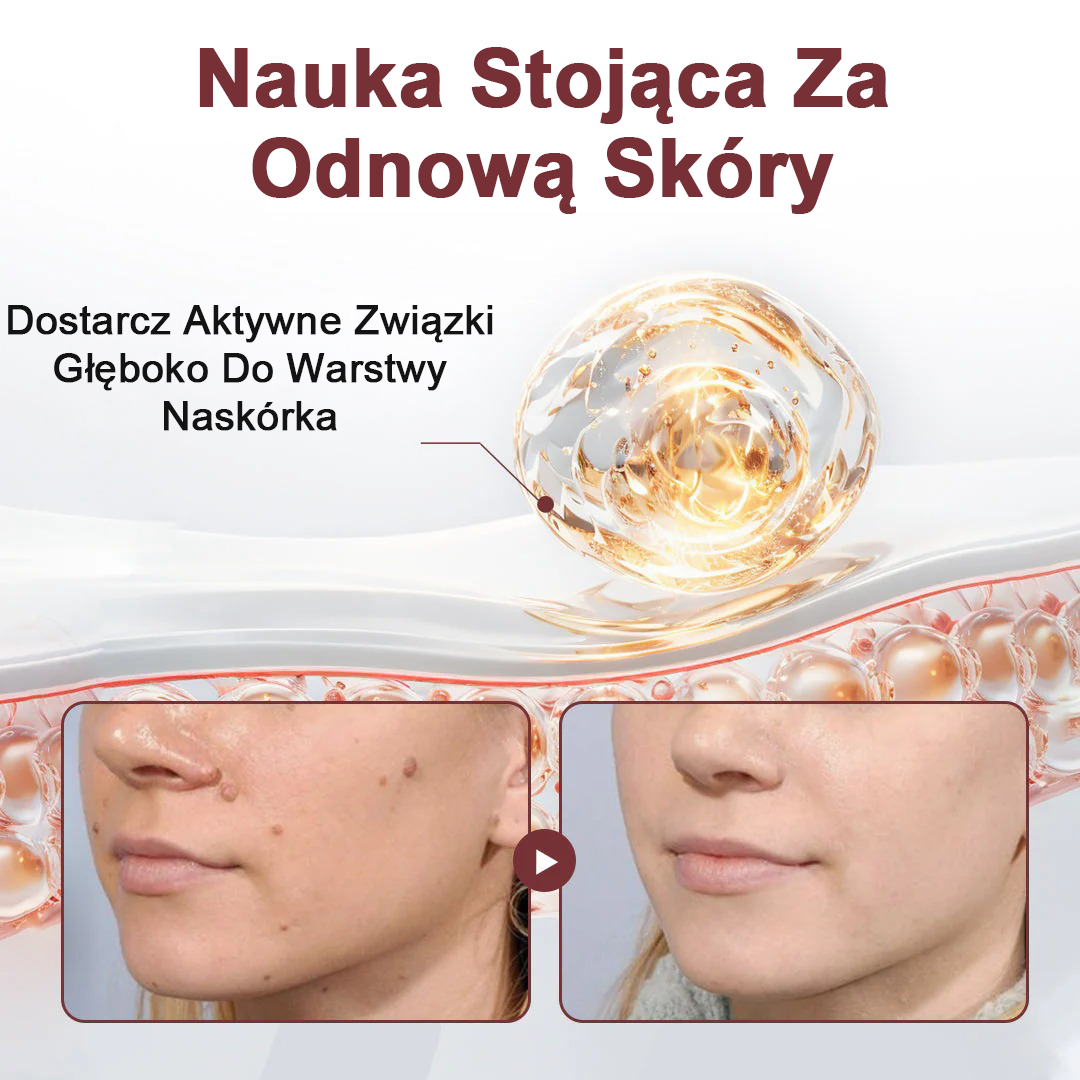 Krem regenerujący Biancat® KeraErase o podwójnym działaniu