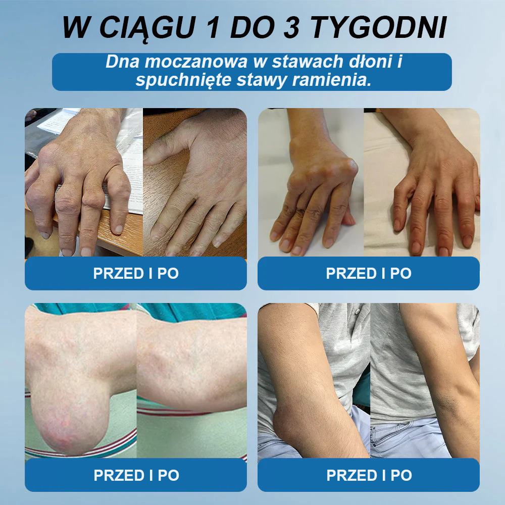 𝖯𝗂𝖼𝗱𝗈® BPC-157 Krem regenerujący stawy 🦴 Skutecznie łagodzi artretyzm, neuropatię, reumatyzm, kontuzje sportowe i wiele więcej 👍