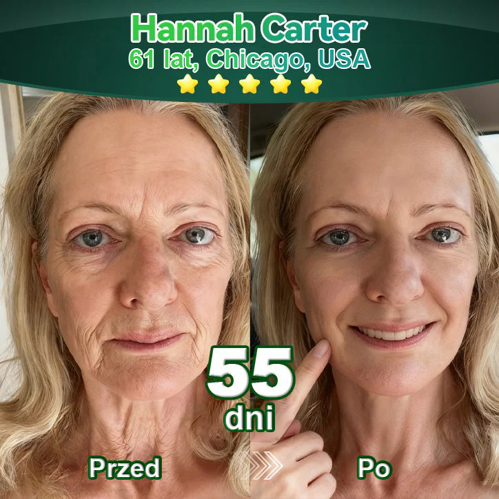 Lotmay® 🚀 Doustne Krople z Komórkami Macierzystymi i Peptydami Kolagenowymi (Ujędrniają i Utrzymują Sprężystość Skóry oraz Zmniejszają Powstawanie Zmarszczek)