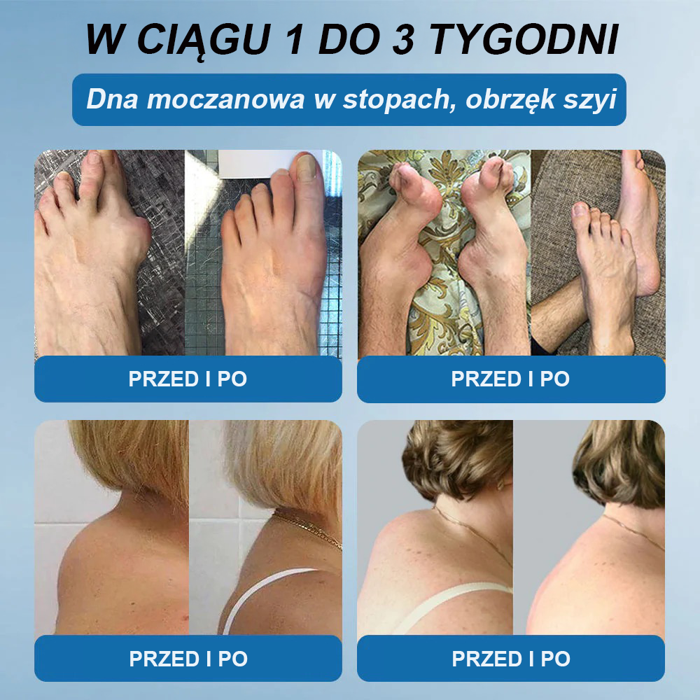 𝖯𝗂𝖼𝗱𝗈® BPC-157 Krem regenerujący stawy 🦴 Skutecznie łagodzi artretyzm, neuropatię, reumatyzm, kontuzje sportowe i wiele więcej 👍
