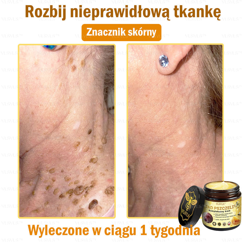VLSVLS™ Krem Komprehensywny z Jadami Pszczół 👩‍⚕️ Rekomendowany przez Dermatologów