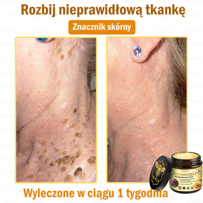 VLSVLS™ Krem Komprehensywny z Jadami Pszczół 👩‍⚕️ Rekomendowany przez Dermatologów