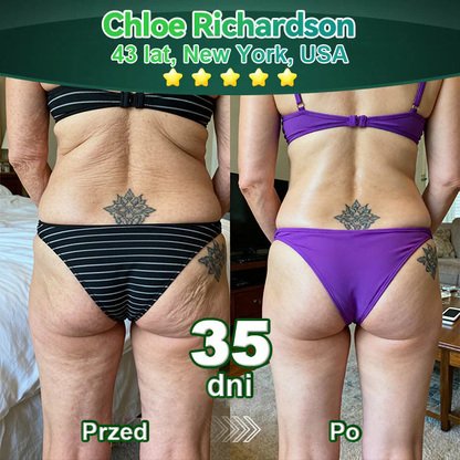 Lotmay® 🚀 Doustne Krople z Komórkami Macierzystymi i Peptydami Kolagenowymi (Ujędrniają i Utrzymują Sprężystość Skóry oraz Zmniejszają Powstawanie Zmarszczek)