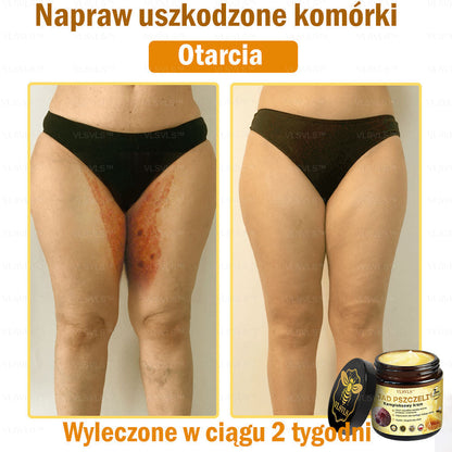 VLSVLS™ Krem Komprehensywny z Jadami Pszczół 👩‍⚕️ Rekomendowany przez Dermatologów