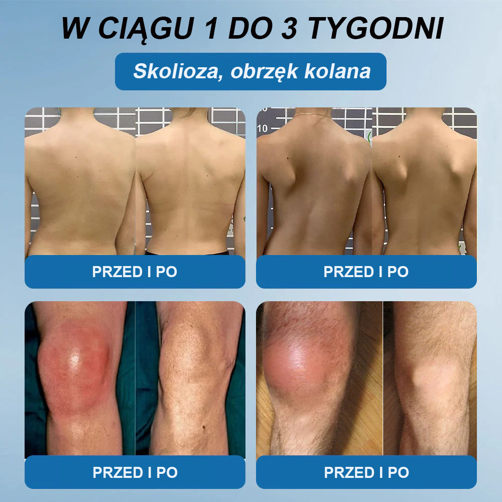 𝖯𝗂𝖼𝗱𝗈® BPC-157 Krem regenerujący stawy 🦴 Skutecznie łagodzi artretyzm, neuropatię, reumatyzm, kontuzje sportowe i wiele więcej 👍