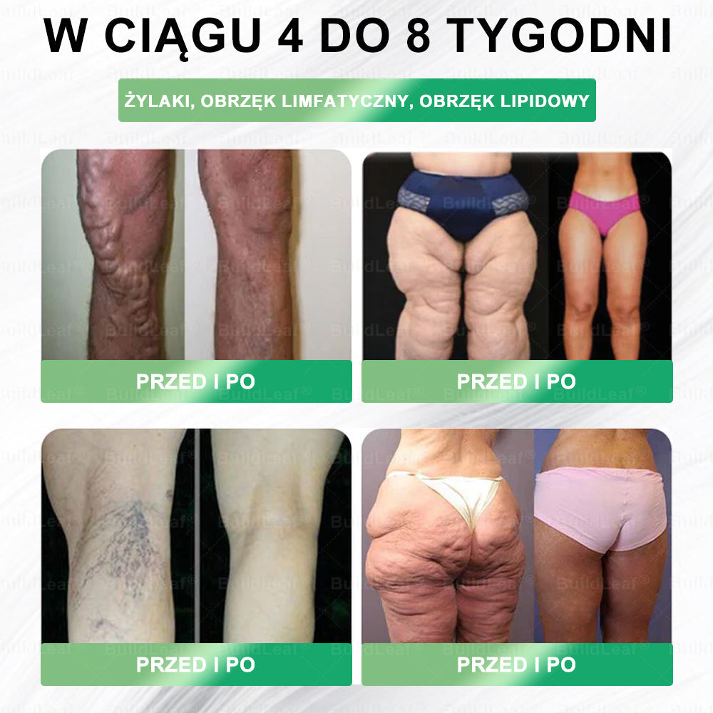 Oficjalny sklep Polska | ☘️☘️BuildLeaf® GLP-1 8-w-1 Fit & Vital Rozwiązanie (Jednorazowe dziennie, widoczne zmiany w ciągu 7 dni) ✅ Otyłość, zdrowie sercowo-naczyniowe, cukrzyca, bezdech senny, zdrowie jelit, problemy ze stawami i inne.