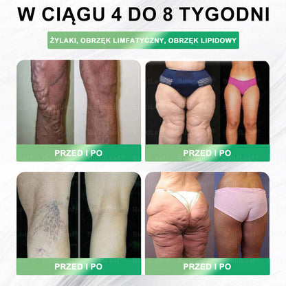 Oficjalny sklep Polska | ☘️☘️BuildLeaf® GLP-1 8-w-1 Fit & Vital Rozwiązanie (Jednorazowe dziennie, widoczne zmiany w ciągu 7 dni) ✅ Otyłość, zdrowie sercowo-naczyniowe, cukrzyca, bezdech senny, zdrowie jelit, problemy ze stawami i inne.