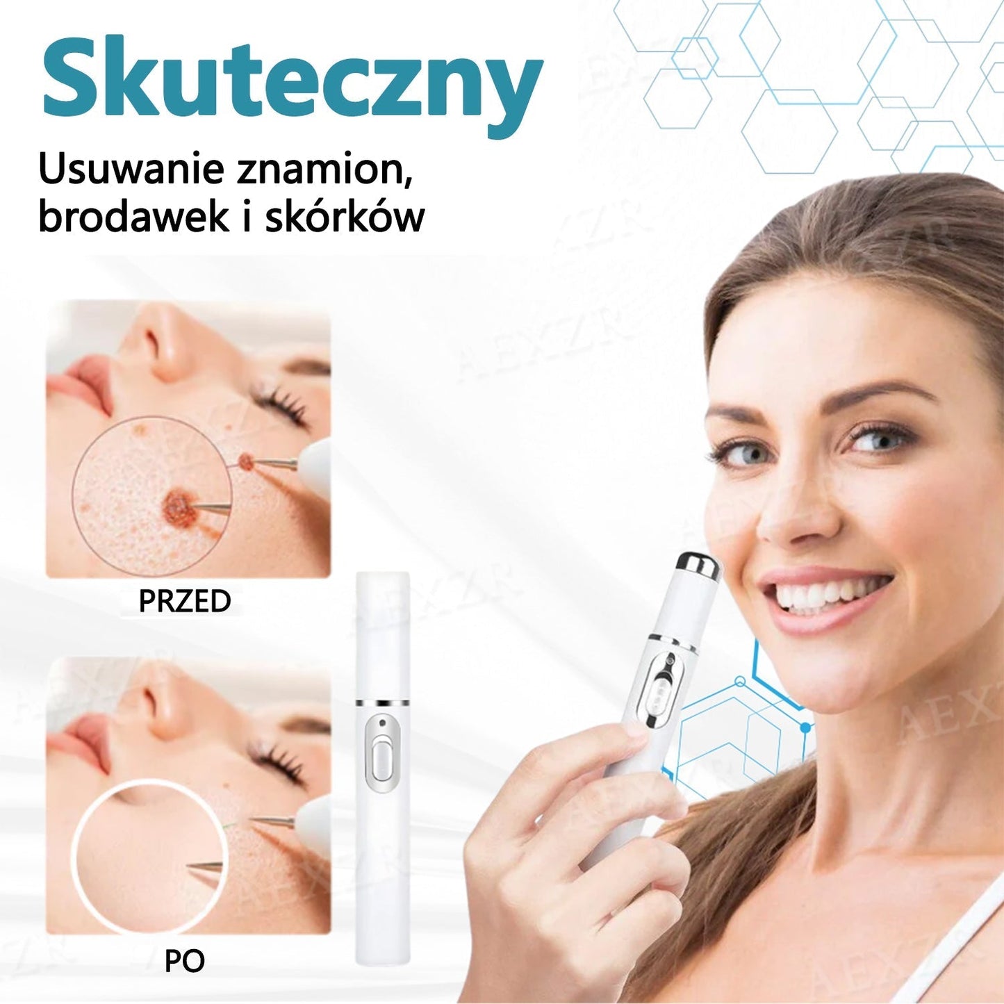 Cvreoz® nowy nieinwazyjny laser do usuwania pieprzyków i brodawek 🎉🎉🎉