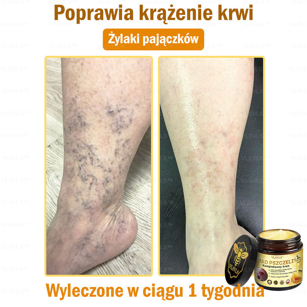 VLSVLS™ Krem Komprehensywny z Jadami Pszczół 👩‍⚕️ Rekomendowany przez Dermatologów