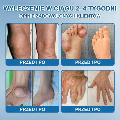 𝖯𝗂𝖼𝗱𝗈® BPC-157 Krem regenerujący stawy 🦴 Skutecznie łagodzi artretyzm, neuropatię, reumatyzm, kontuzje sportowe i wiele więcej 👍