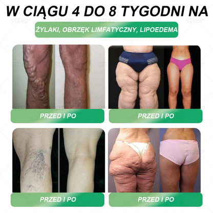 Polecane przez Mayo Clinic | Oficjalny sklep 👨‍⚕️HHVB® GLP-1 doustny roztwór na odchudzanie 💥 Otyłość, choroby układu krążenia, cukrzyca, bezdech senny, problemy ze stawami i inne