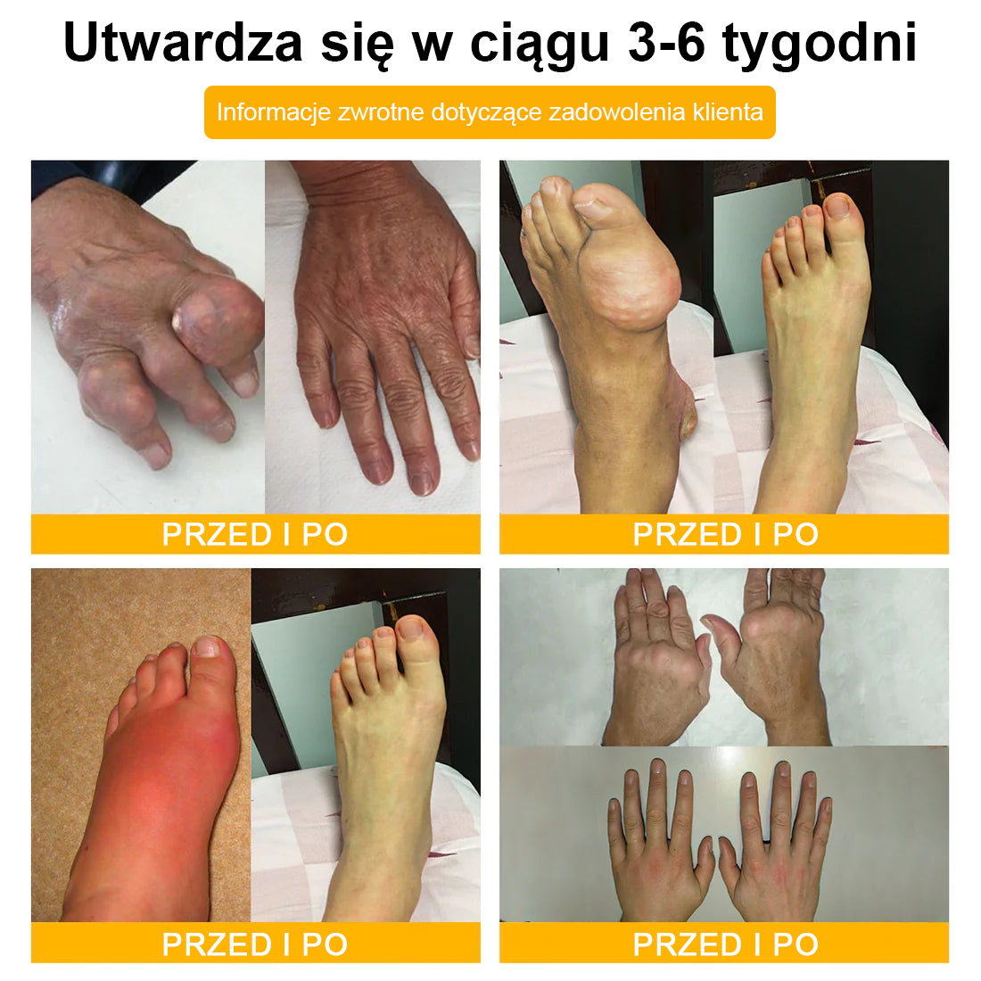 TLOPA® Toksyna botulinowa i jad pszczeli Balsam Łagodzący Ból i Leczenie Kości🐝🌿 (Polecane dla seniorów przez ortopedów)🔥🔥