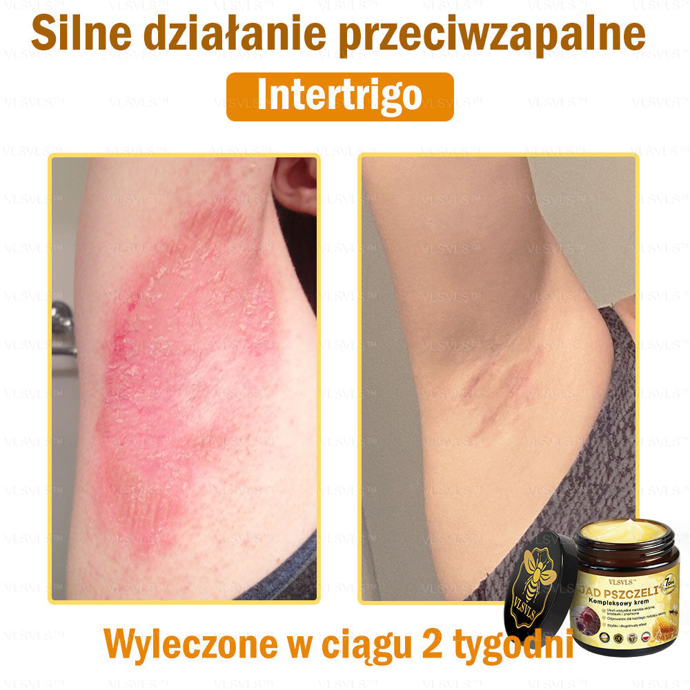 VLSVLS™ Krem Komprehensywny z Jadami Pszczół 👩‍⚕️ Rekomendowany przez Dermatologów