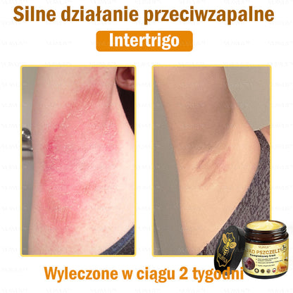 VLSVLS™ Krem Komprehensywny z Jadami Pszczół 👩‍⚕️ Rekomendowany przez Dermatologów