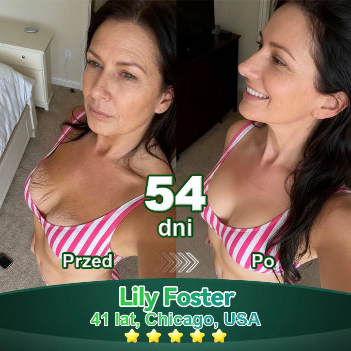 Lotmay® 🚀 Doustne Krople z Komórkami Macierzystymi i Peptydami Kolagenowymi (Ujędrniają i Utrzymują Sprężystość Skóry oraz Zmniejszają Powstawanie Zmarszczek)