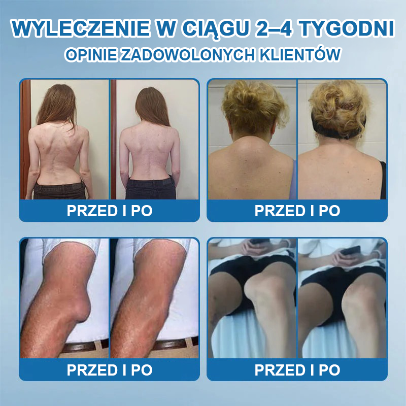 𝖯𝗂𝖼𝗱𝗈® BPC-157 Krem regenerujący stawy 🦴 Skutecznie łagodzi artretyzm, neuropatię, reumatyzm, kontuzje sportowe i wiele więcej 👍
