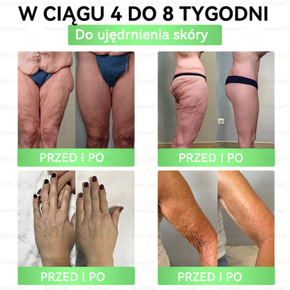 A♻️𝖮𝖋𝗶𝗰𝗷𝗮𝗹𝗻𝘆 𝘀𝗸𝗹𝗲𝗽 | 👩‍⚕️Solmira® 𝗚𝗟𝗣-𝟭 𝟖-w-𝟭 Smukły i zdrowy roztwór doustny (𝑟𝑎𝑧 𝑑𝑧𝑖𝑒𝑛𝑛𝑖𝑒, 𝑟𝑒𝑧𝑢𝑙𝑡𝑎𝑡𝑦 𝑤 7 𝑑𝑛𝑖),Wspiera odchudzanie, serce, cukrzycę, sen, jelita, stawy, a także ujędrnia skórę i dodaje energii