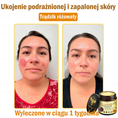 VLSVLS™ Krem Komprehensywny z Jadami Pszczół 👩‍⚕️ Rekomendowany przez Dermatologów