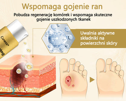 Cvreoz® Leczniczy spray do stóp cukrzycowych- zawiera jad pszczeli, który przyspiesza gojenie i zapobiega infekcjom!🌿🌿🌿