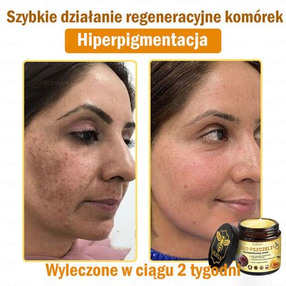 VLSVLS™ Krem Komprehensywny z Jadami Pszczół 👩‍⚕️ Rekomendowany przez Dermatologów