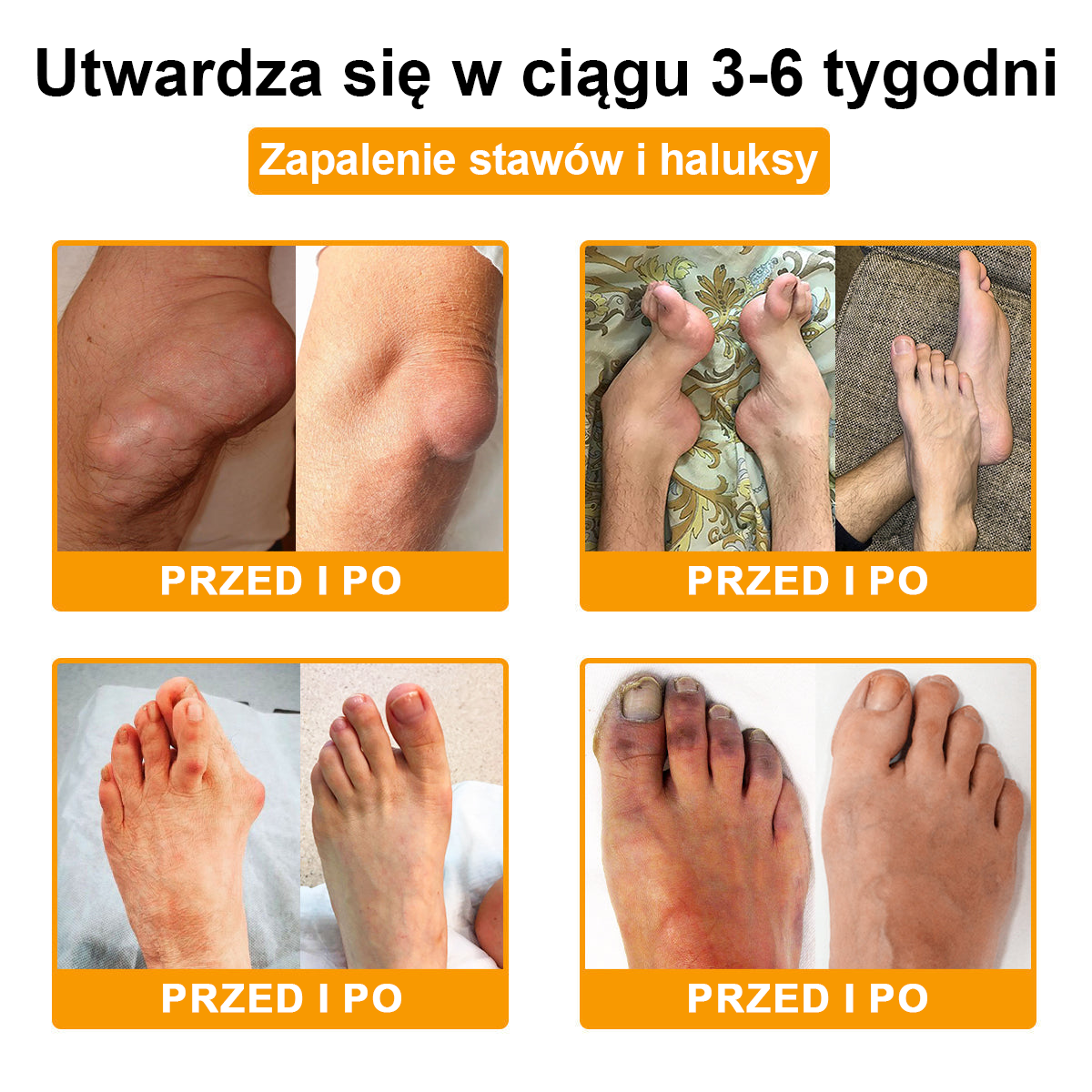 TLOPA® Toksyna botulinowa i jad pszczeli Balsam Łagodzący Ból i Leczenie Kości🐝🌿 (Polecane dla seniorów przez ortopedów)🔥🔥