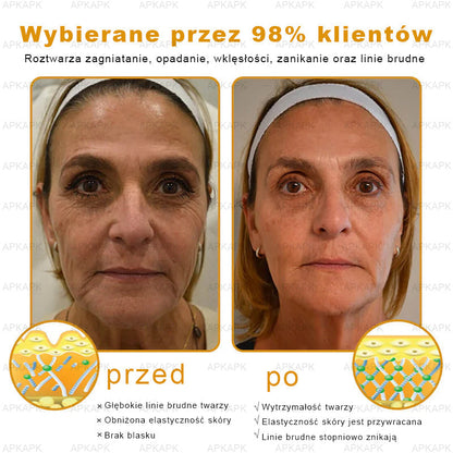 ΑPΚΑPK™ Jad Pszczoły Kompleksowy Krem🥇🥇pomaga w leczeniu problemów skórnych, takich jak: zmarszczki, blizny, plamy pigmentacyjne, rozstępy, trądzik, łuszczyca, egzema, zmiany skórne, podrażnienia, stany zapalne i inne problemy skórne🔥